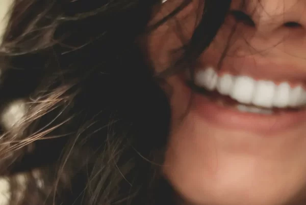 Maloclusion_dental